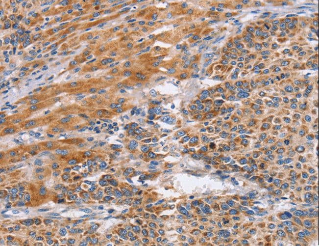Polyclonal Rabbit anti-Human SIGLEC6 Antibody (IHC)