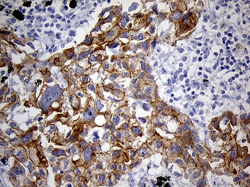 LAD1 Antibody (aa271-517, clone OTI7H8)