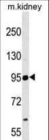 NCAM2 Antibody (aa620-649)