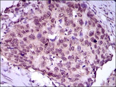MEF2C Antibody (Amino Acid: 1-125, clone 6H2G2)