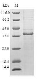 Human COT / CROT Protein (Recombinant GST, N-terminus)