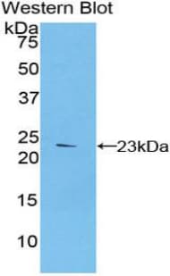 FBN1 / Fibrillin 1 Antibody (aa957-1143)
