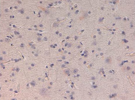 Kinesin Heavy Chain / KIF5B Antibody
