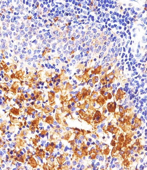 SYN / FYN Antibody (clone 1302CT390.118.237)