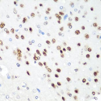 CDK1 / CDC2 Antibody