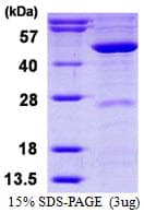 Human MVD Protein (Recombinant His)