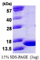 Mouse TNF Alpha Protein (Recombinant)