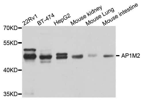 Polyclonal Rabbit anti-Human AP1M2 Antibody (IHC, WB)
