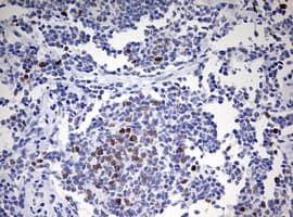TOP2A / Topoisomerase II Alpha Antibody (aa1100-1531, clone OTI5E6, Carrier-free)