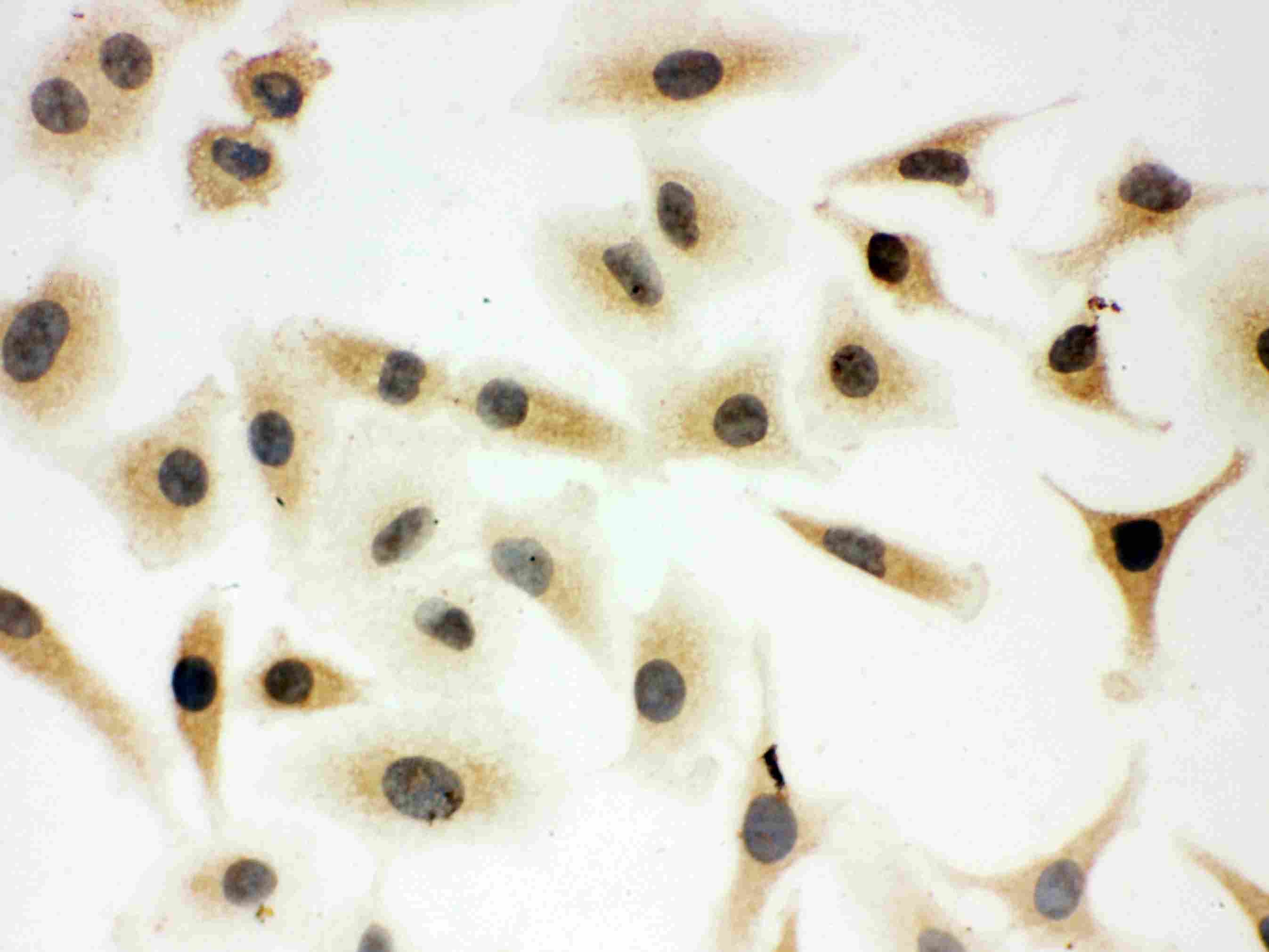 Polyclonal Rabbit anti-Human p66 / SHC Antibody (aa424-440, IHC, WB)