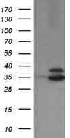 OTUB1 / OTU1 Antibody (clone OTI1E3)