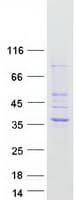 Human HSD17B13 Protein (Recombinant Myc-DDK (Flag))