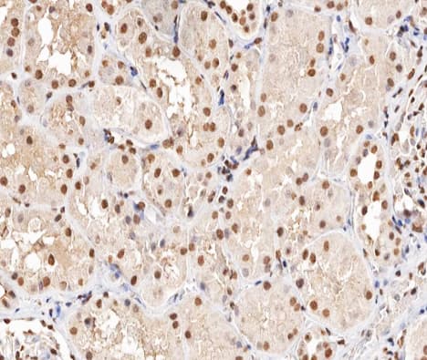 MAPKAPK5 / PRAK Antibody (phospho-Thr182)