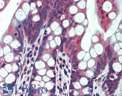 IHC-plus™ Polyclonal Rabbit anti-Human CCDC88A / GIV / Girdin Antibody (aa1425-1475, IHC, WB)