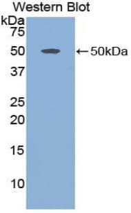 ADIPOR2 Antibody (aa2-155, APC)