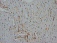 DES / Desmin Antibody (clone DES-82, Sepharose)
