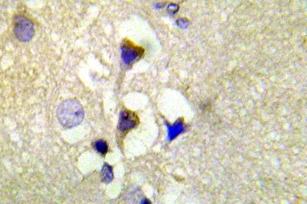 Polyclonal Rabbit anti-Human PRKD1 / PKC Mu Antibody (phospho-Ser910, IHC, WB)