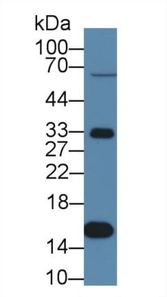 TTR / Transthyretin Antibody (aa21-150)