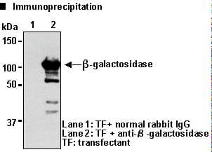 Polyclonal Rabbit GLB1 / Beta-Galactosidase Antibody (IHC, WB)
