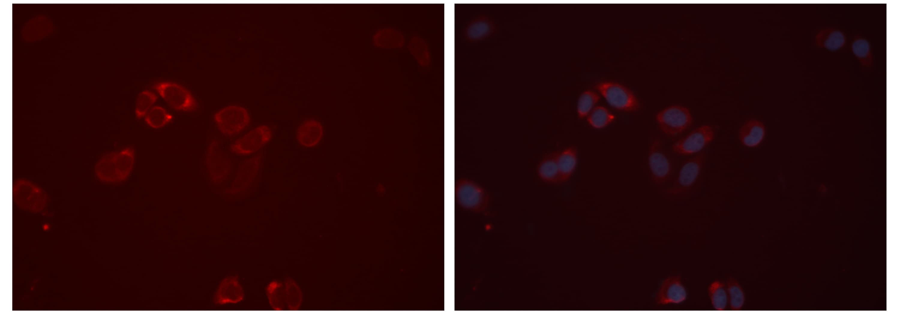 EDNRB / Endothelin B Receptor Antibody