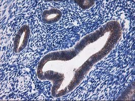 ALDH3A2 Antibody (clone OTI2A7)