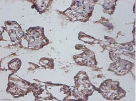 IL12B / IL12 p40 Antibody