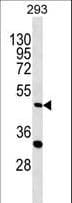 ALKBH5 Antibody (aa302-330)