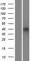 ADH6 Protein (Over-Expression Lysate Myc-DDK (Flag))