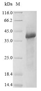 Human WNT5A Protein (Recombinant 6His, N-terminus)
