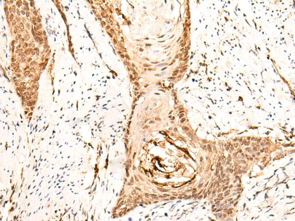 Polyclonal Rabbit anti-Human C11orf30 / EMSY Antibody (IHC)