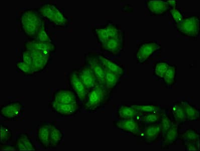 PSF1 / GINS2 Antibody