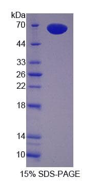 Mouse PZP Protein (Recombinant His-GST)