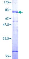 Human P3H1 / LEPRE1 Protein (Recombinant GST)