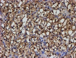 PSMB9 Antibody (aa21-219, clone OTI2G6)