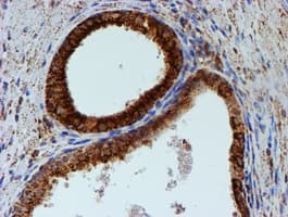 PSMB9 Antibody (clone OTI1G7)