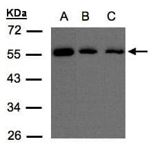 IHC-plus™ OSBPL2 Antibody (aa418-480)