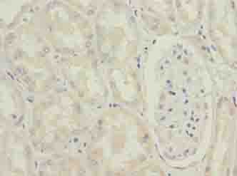 MRPL49 Antibody