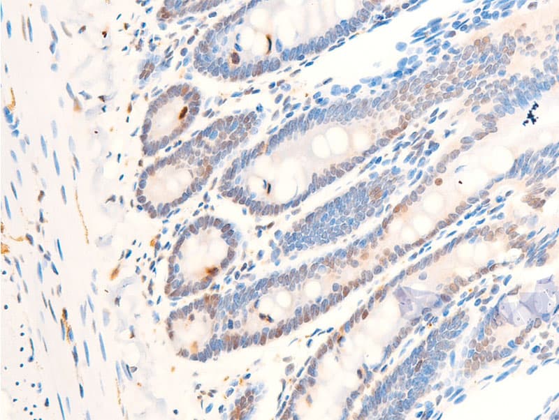 MYC / c-Myc Antibody (phospho-Thr58)
