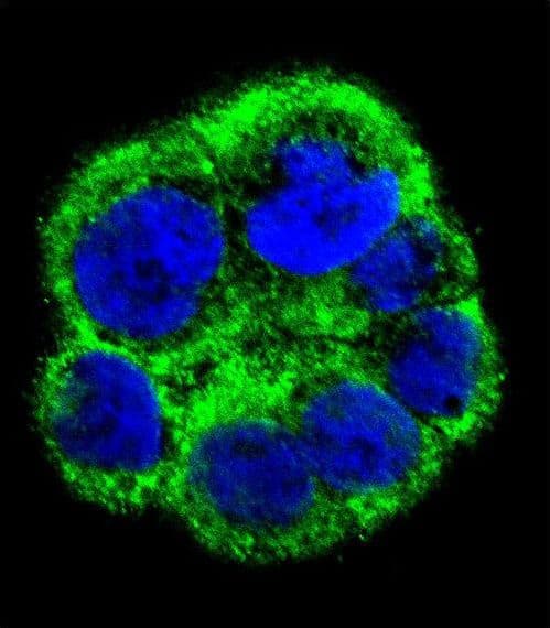 PCYT1A / CCT Alpha Antibody (aa27-54)