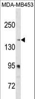 RRBP1 / hES Antibody (aa1327-1355)