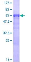 Human PDLIM2 / SLIM Protein (Recombinant GST)