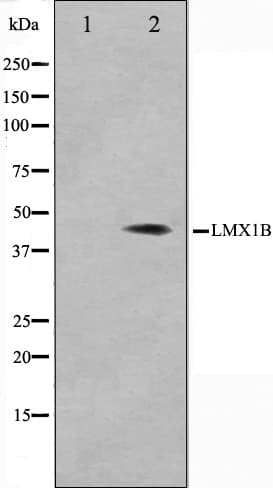 Polyclonal Rabbit anti-Human LMX1B Antibody (IF, WB)