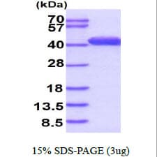 Human CAPG Protein (Recombinant)