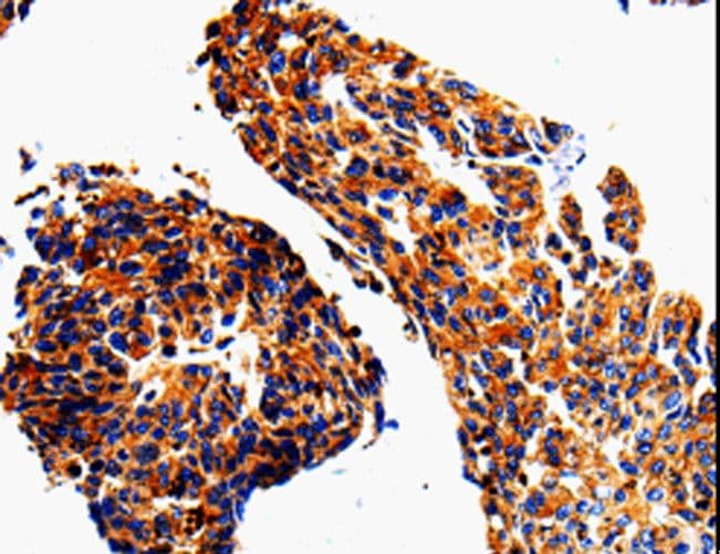 ADD1 / Adducin Alpha Antibody