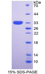 Human NPTX2 Protein (Recombinant His-T7)
