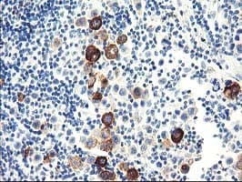Monoclonal Mouse anti-Human Dipeptidylpeptidase 10 / DPP10 Antibody (clone OTI2A5, IHC, WB)