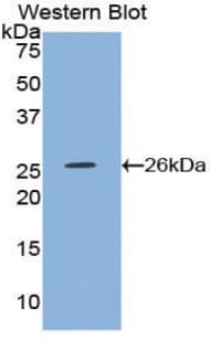 TRXR1 / TXNRD1 Antibody (aa374-577)