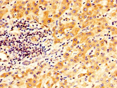 TGM2 / Transglutaminase 2 Antibody