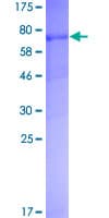 Human STK38 Protein (Recombinant GST)