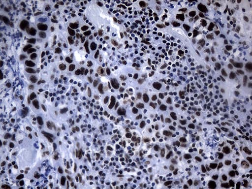 Monoclonal Mouse anti-Human POLR2A / RNA polymerase II Antibody (clone OTI3C8, aa1351-1614, IHC, WB)